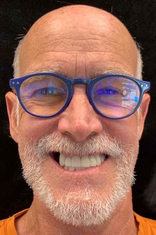 After a smile makeover with Ocean Dentistry Co Team in New Jersey