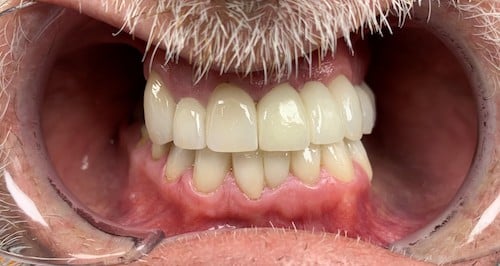 Before a smile makeover