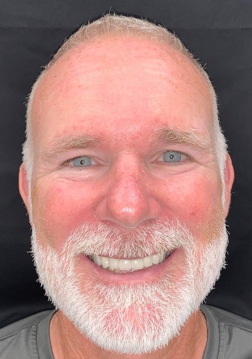 After a smile makeover with Ocean Dentistry Co Team