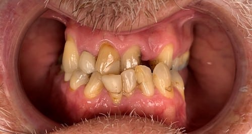 Before a smile makeover
