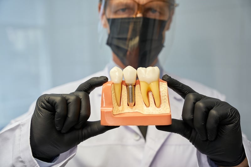 Belmar Dental Implants