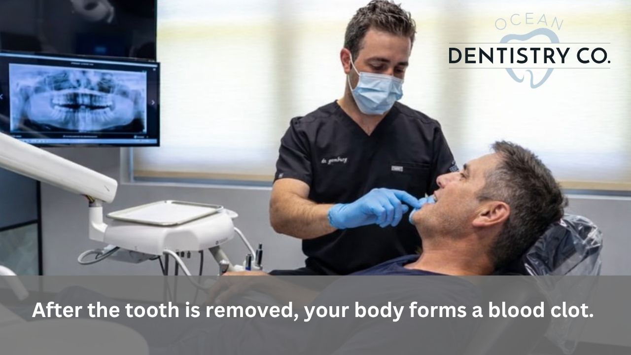 How Can I Tell a Normal Socket After Tooth Extraction?
