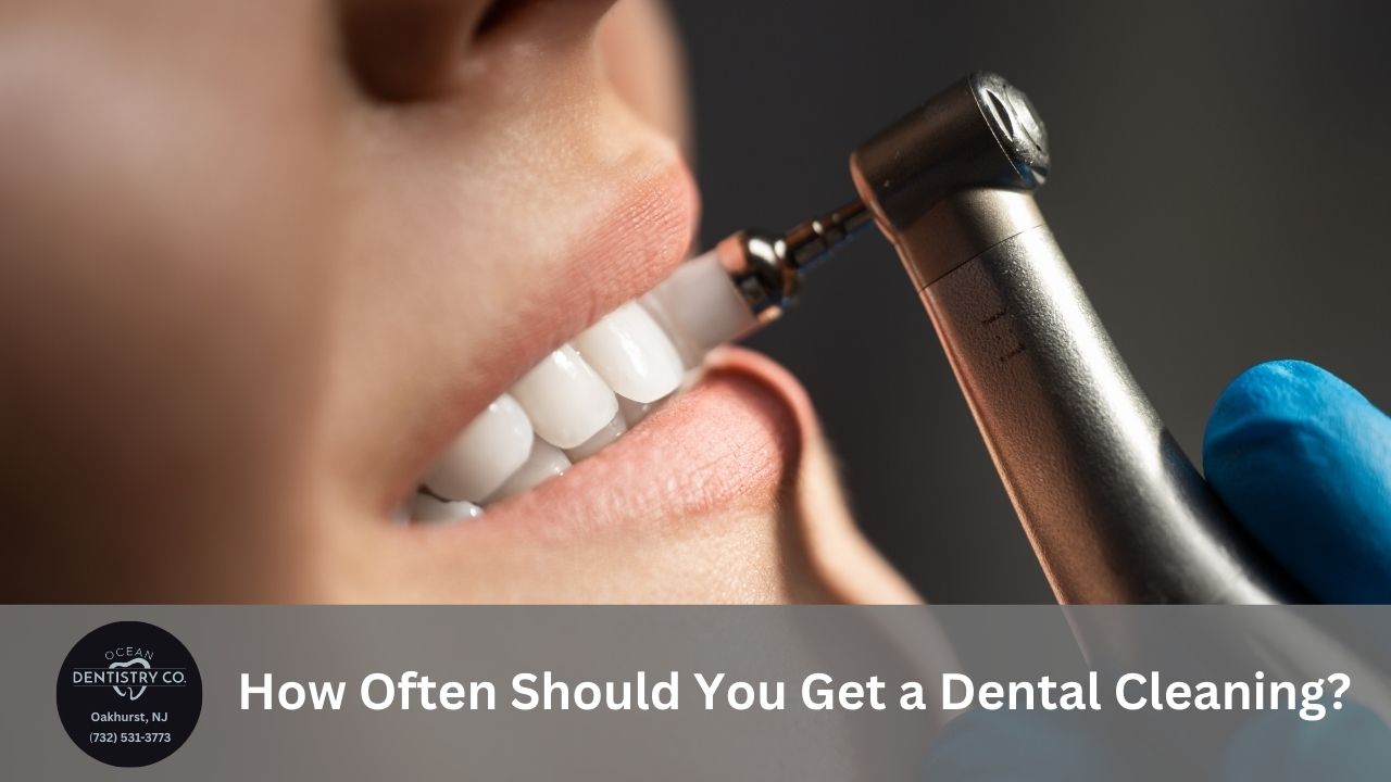 How Often Should You Get a Dental Cleaning? Ocean Dentistry