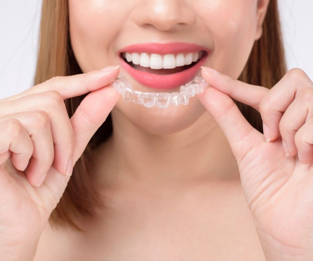 Orthodontic treatment as an adult can dramatically improve your personal appearance, self-esteem, and your health. 